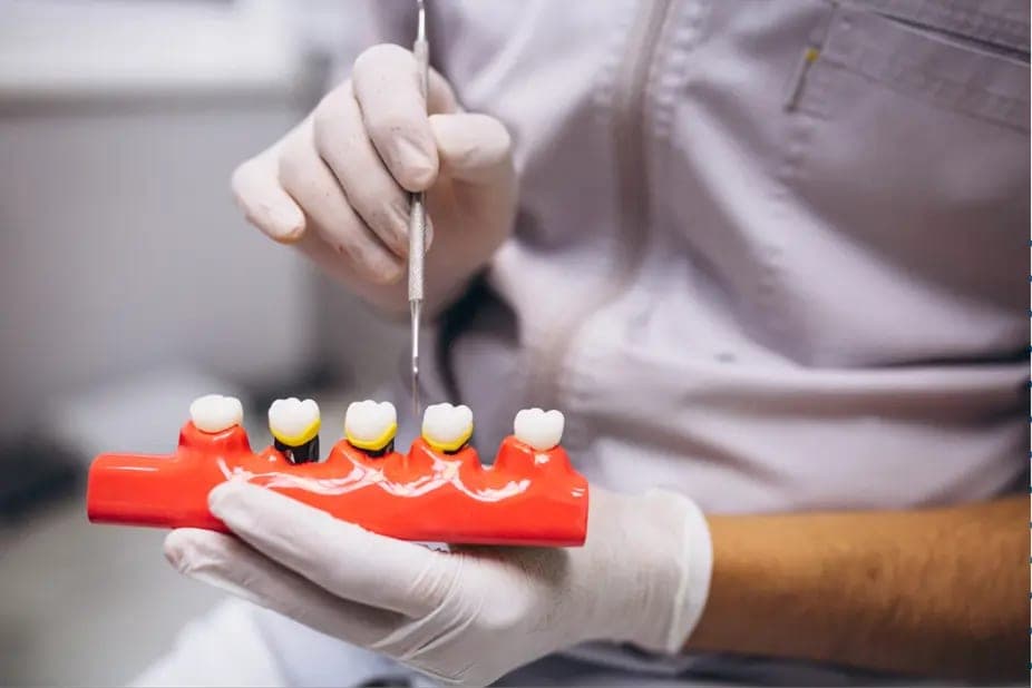 A gloved hand holding a tray of implant and crown components