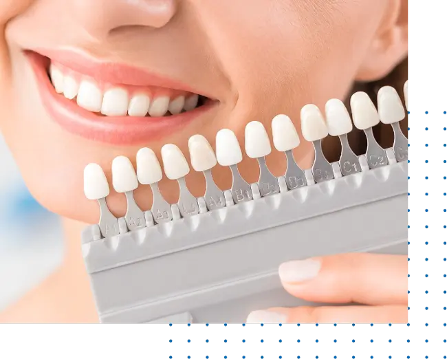 Low Cost Dental Bridges In Los Angeles