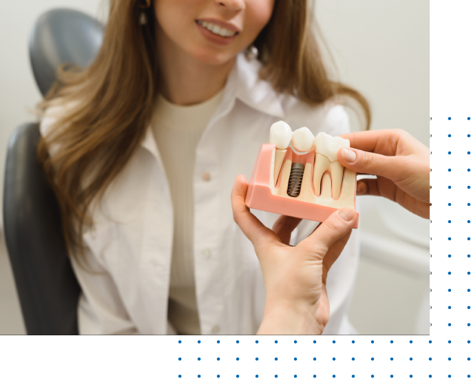 Teeth Dental Implants In Los Angeles
