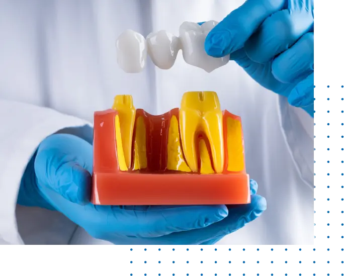 Affordable Dental Bridges In California