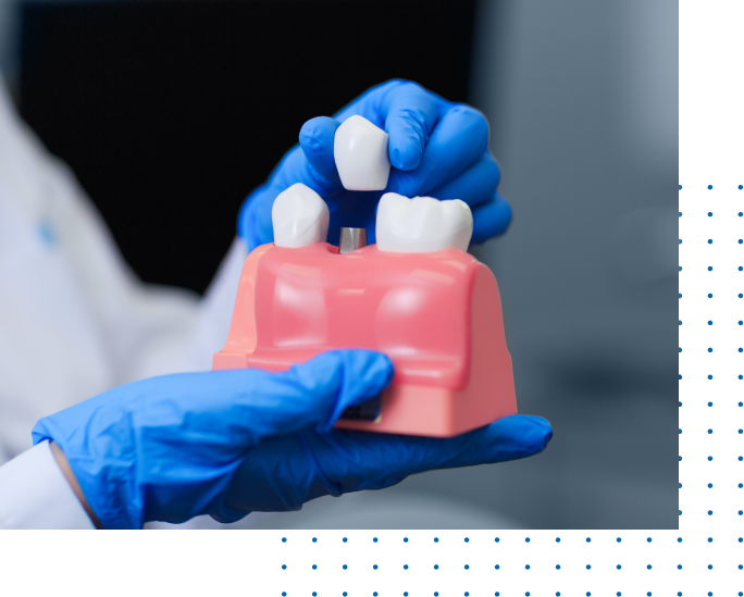 Low Cost Dental Crowns Near Me