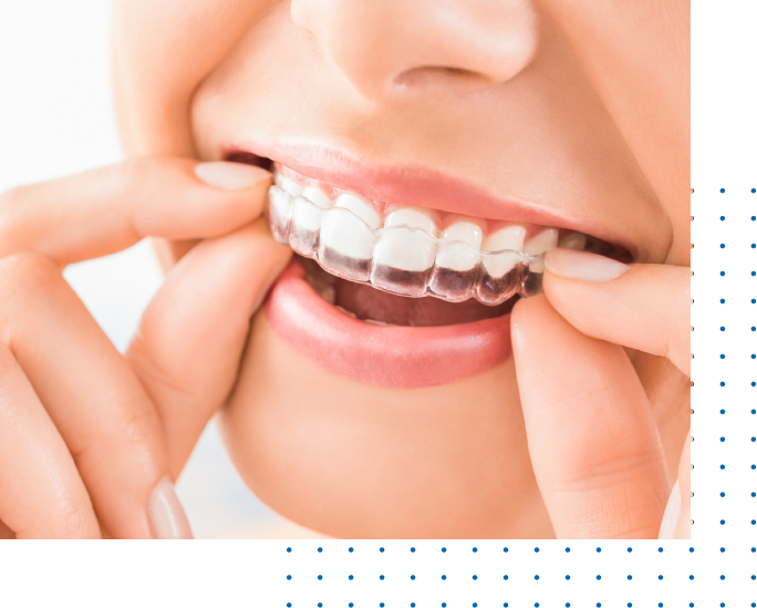 360 Best Invisalign Los Angeles