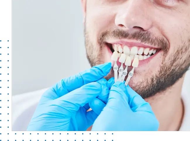 Teeth Veneers Los Angeles