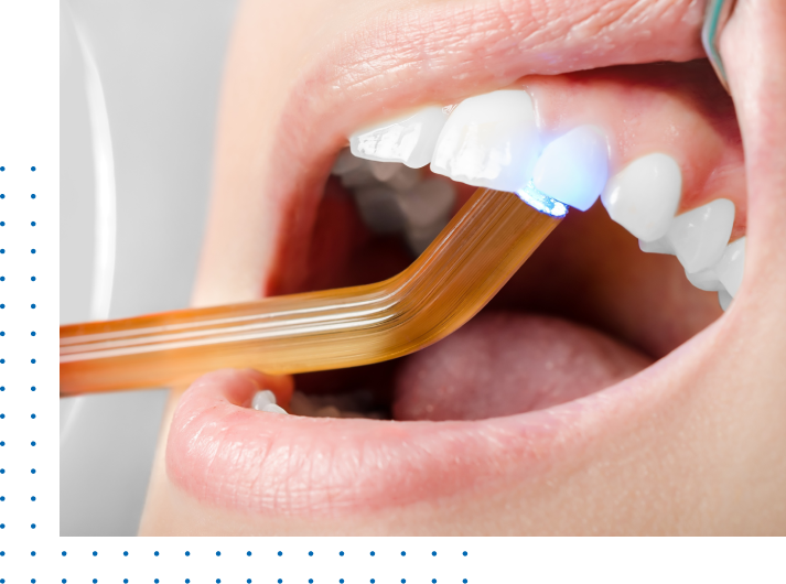 Dentists Composite Fillings