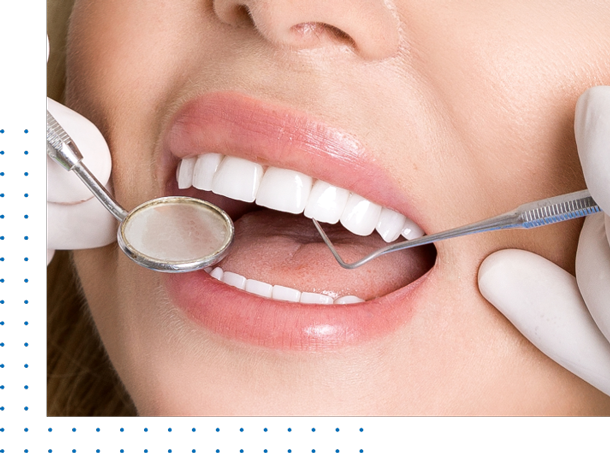 Porcelain Veneers Los Angeles