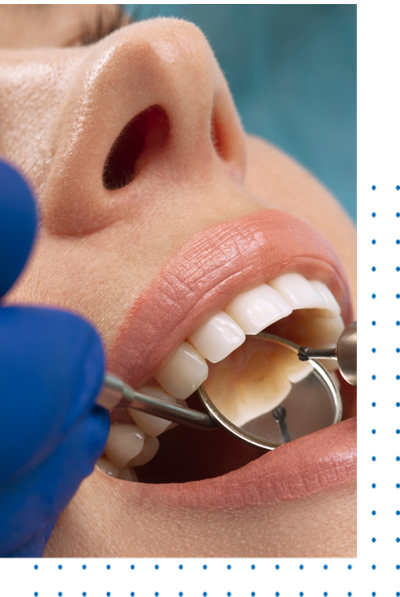 360 Dental Fillings East Los Angeles