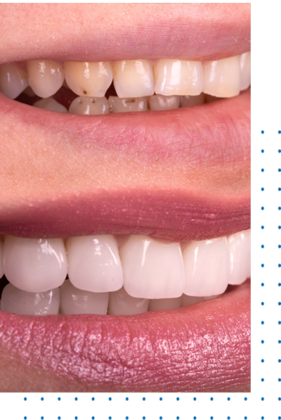 Best Restorative Dentistry In Ca