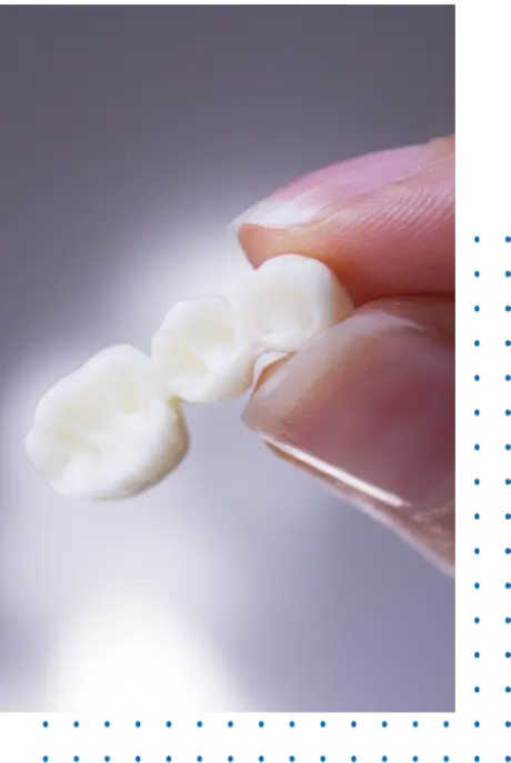 Fixed Dental Bridge Near Me
