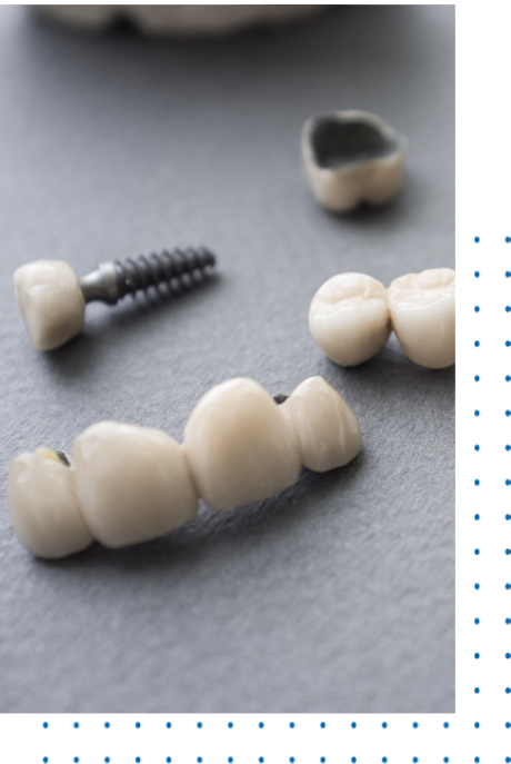 Affordable Full Mouth Reconstruction
