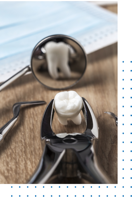 Surgical Tooth Extraction Near Me