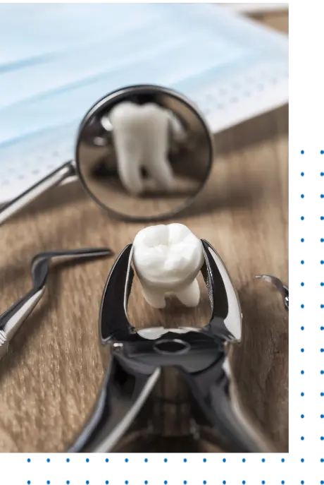 Surgical Tooth Extraction Near Me