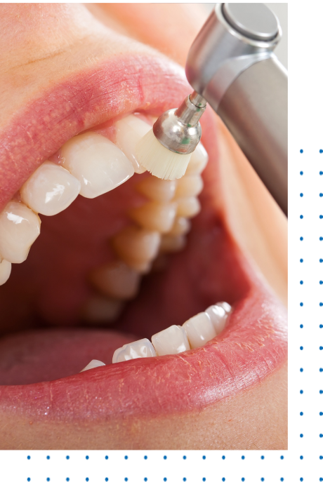 Cheap Deep Teeth Cleaning Near Me