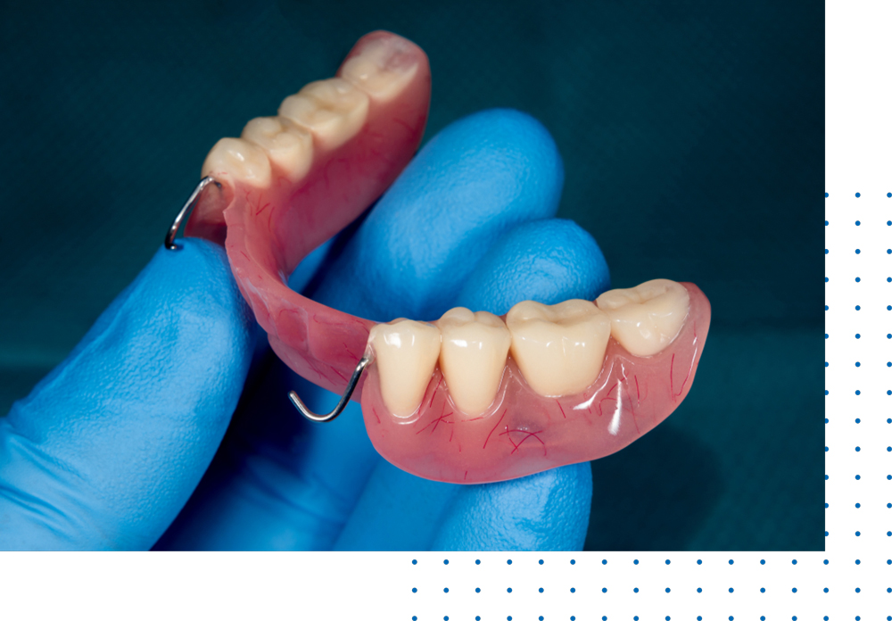 Best Dental Partial Dentures in Los Angeles
