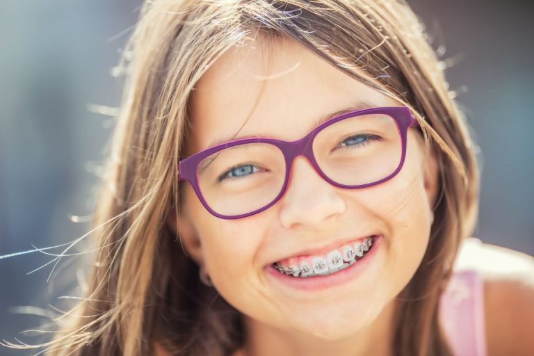 Read more about the article How To Maintain Oral Hygiene With Braces?