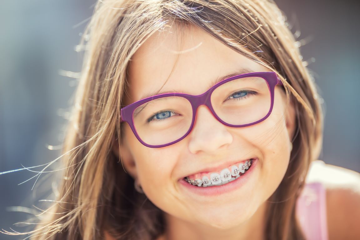 You are currently viewing How To Maintain Oral Hygiene With Braces?
