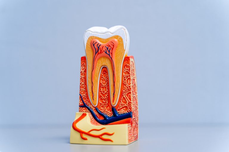 Read more about the article How to Avoid a Root Canal