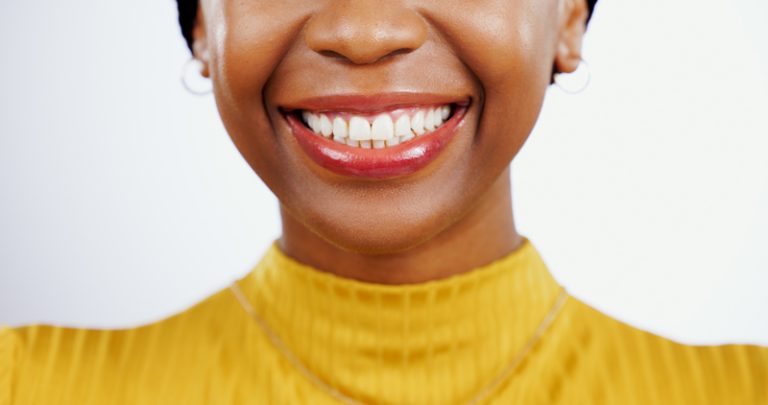 Read more about the article How Composite Fillings Blend Seamlessly with Your Natural Teeth