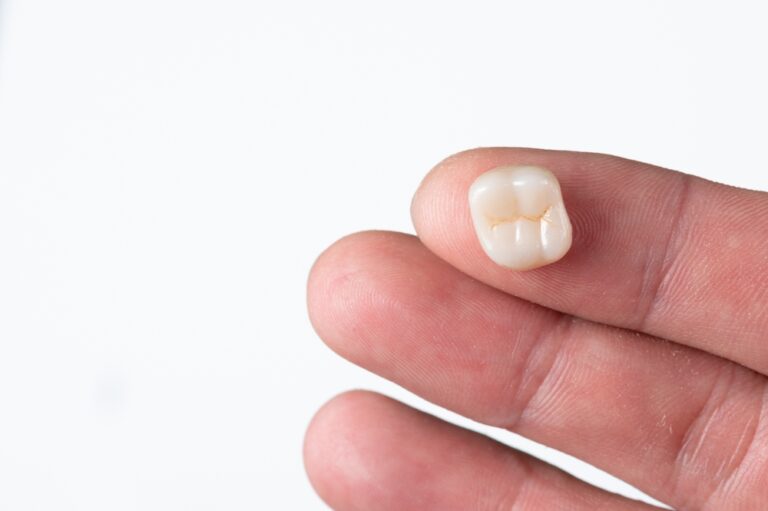 Read more about the article Everything You Need to Know Before Getting A Dental Crown